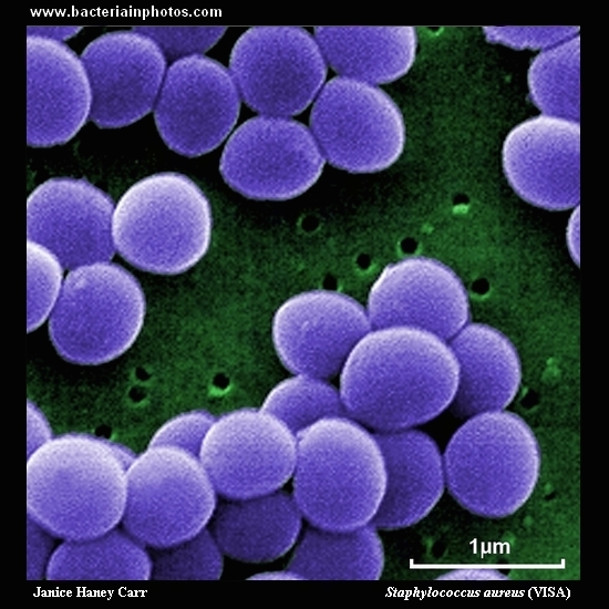 Staphylococcus aureus   
                         microscopy, sem, high magnification
